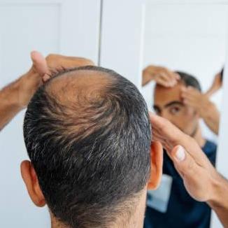 Hair Transplant  In Riyadh